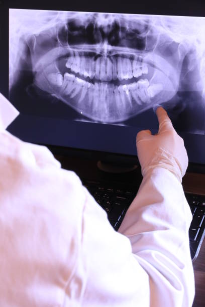 Best Emergency Dental Extractions in Rion Center, MA