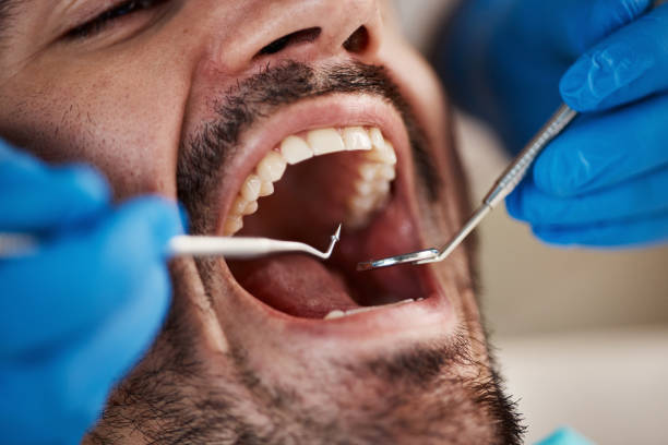 Best Emergency Dentist for Special Needs Patients in Rion Center, MA